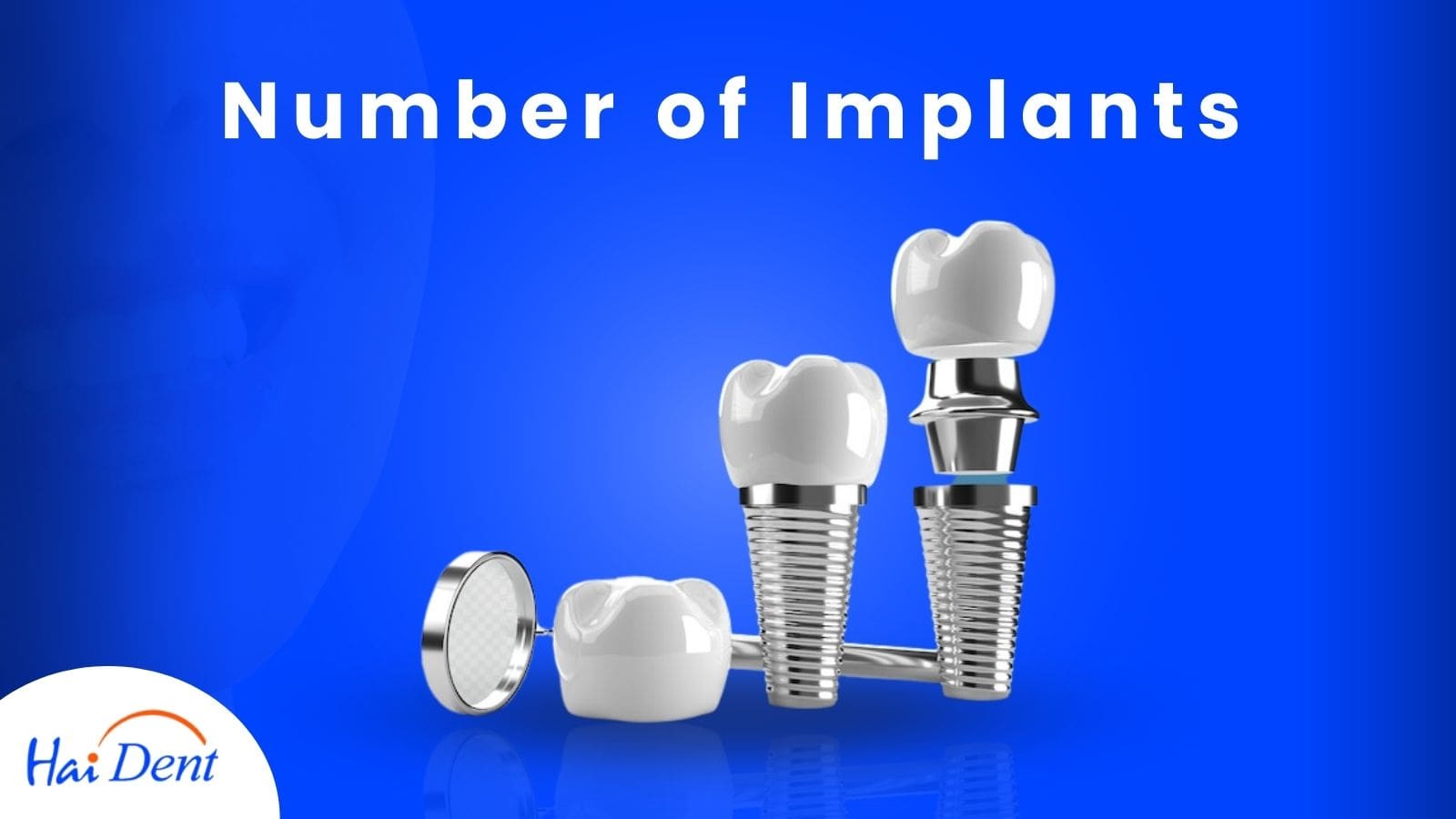 one day full mouth dental implants cost